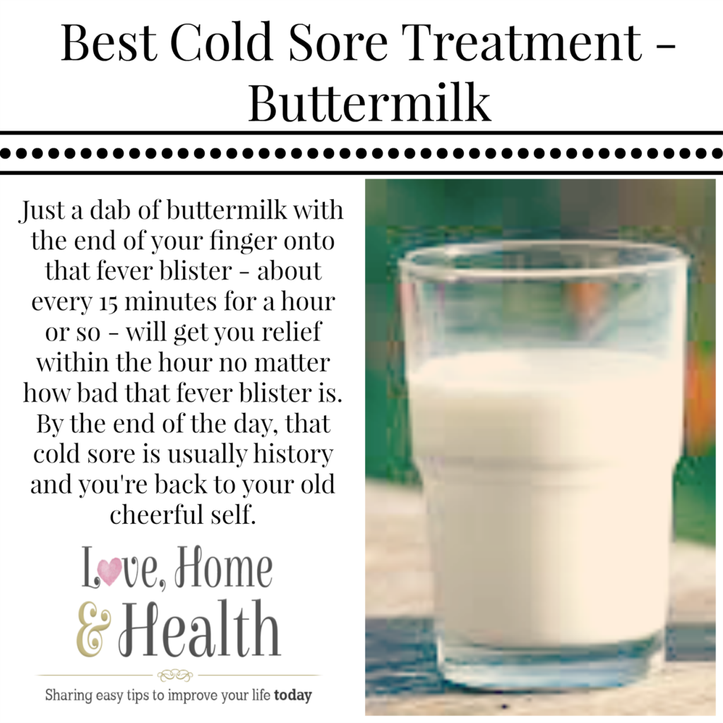 Buttermilk fever blister treatment